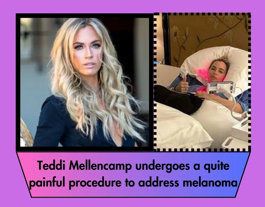 Teddi Mellencamp undergoes a quite painful procedure to address melanoma