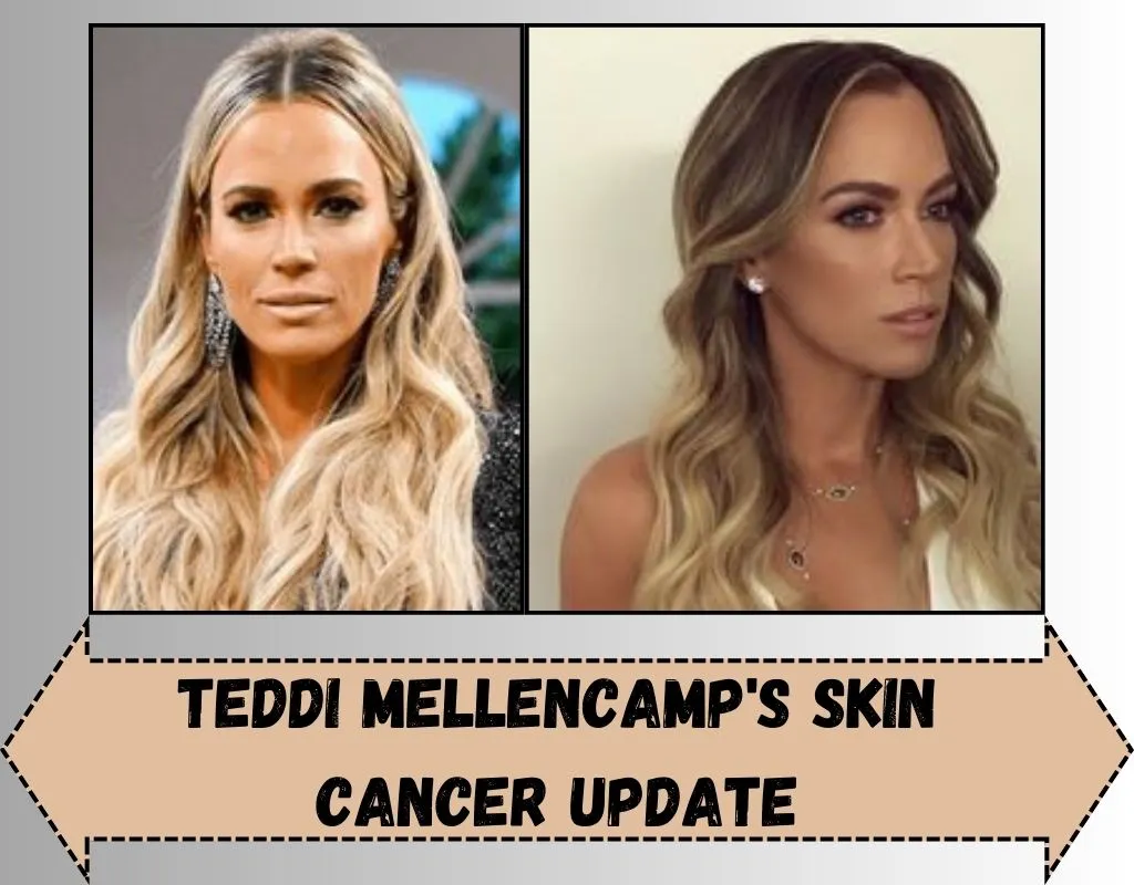 Teddi Mellencamp's Skin Cancer Update: Holding Hope